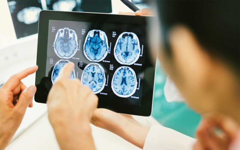 Fingers pointing at a scanning of a brain on iPad